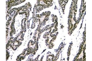 IHC analysis of NFIA using anti-NFIA antibody (ABIN6719349). (NFIA 抗体  (Middle Region))