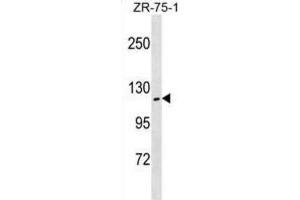 Western Blotting (WB) image for anti-Zinc Fingers and Homeoboxes 2 (ZHX2) antibody (ABIN3000459) (ZHX2 抗体)