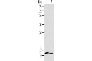 Gel: 10 % SDS-PAGE, Lysate: 40 μg, Lane 1-2: Mouse brain tissue, Mouse kidney tissue, Primary antibody: ABIN7130528(PAGE2 Antibody) at dilution 1/400, Secondary antibody: Goat anti rabbit IgG at 1/8000 dilution, Exposure time: 1 minute (PAGE2 抗体)