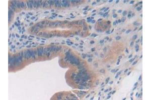 Immunohistochemistry (IHC) image for anti-Glypican 3 (GPC3) (AA 344-559) antibody (ABIN7442228)
