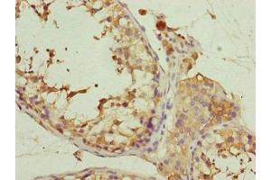 Immunohistochemistry of paraffin-embedded human testis tissue using ABIN7152171 at dilution of 1:100 (Eukaryotic Translation Initiation Factor 3, Subunit M (EIF3M) (AA 1-374) 抗体)