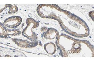 ABIN6273587 at 1/100 staining Human prostate tissue by IHC-P. (TCHP 抗体  (C-Term))