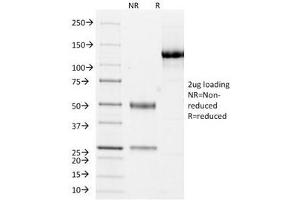 SDS-PAGE Analysis of Purified, BSA-Free Cytokeratin 10/13 Antibody (clone DE-K13). (Keratin 10/13 抗体)