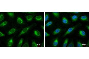 ICC/IF Image FACL4 antibody [C3], C-term detects FACL4 protein at endoplasmic reticulum by immunofluorescent analysis. (ACSL4 抗体  (C-Term))