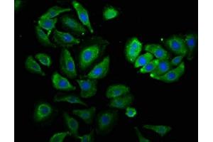 Immunofluorescence staining of A549 cells with ABIN7142230 at 1:530, counter-stained with DAPI. (PSMC3 抗体  (Regulatory Subunit 6A))