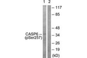 Western blot analysis of extracts from 293 cells treated with Etoposide 25uM 60', using Caspase 6 (Phospho-Ser257) Antibody. (Caspase 6 抗体  (pSer257))