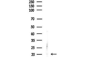 anti-S100 Calcium Binding Protein A16 (S100A16) (Internal Region) antibody