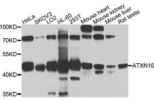 Western blot analysis of extracts of various cells, using ATXN10 antibody. (Ataxin 10 抗体)