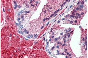 Human Prostate (formalin-fixed, paraffin-embedded) stained with TRAF2 antibody ABIN297934 at 5 ug/ml followed by biotinylated anti-mouse IgG secondary antibody ABIN481714, alkaline phosphatase-streptavidin and chromogen. (TRAF2 抗体  (AA 205-222))