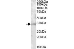 BTLA polyclonal antibody  (1 ug/mL) staining of mouse spleen lysate (35 ug protein in RIPA buffer). (BTLA 抗体)