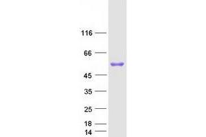 Western Blotting (WB) image for Fibrinogen gamma Chain (FGG) protein (Myc-DYKDDDDK Tag) (ABIN2721162)