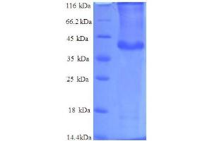 SDS-PAGE (SDS) image for Protein Phosphatase 1, Regulatory (Inhibitor) Subunit 11 (PPP1R11) (AA 1-126), (full length) protein (GST tag) (ABIN7479617)