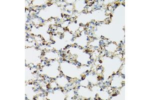 Immunohistochemistry of paraffin-embedded mouse lung using TLR1 Rabbit pAb (ABIN3023654, ABIN3023655, ABIN3023656 and ABIN6214092) at dilution of 1:100 (40x lens). (TLR1 抗体  (AA 30-290))