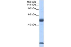 Western Blotting (WB) image for anti-Pre-mRNA Branch Site Protein p14 (SF3B14) antibody (ABIN2462263) (Pre-mRNA Branch Site Protein p14 (SF3B14) 抗体)