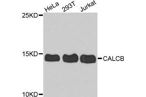 Western blot analysis of extracts of various cell lines, using CALCB antibody.