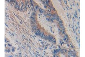 Immunohistochemistry (IHC) image for anti-Glycine Dehydrogenase (GLDC) (AA 81-268) antibody (ABIN7438277)