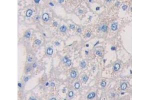 IHC-P analysis of Human Tissue, with DAB staining. (IL-6 Receptor 抗体  (AA 216-356))