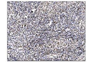 IHC analysis of Ornithine Aminotransferase/OAT using anti-Ornithine Aminotransferase/OAT antibody (ABIN7600649). (OAT 抗体  (AA 214-439))