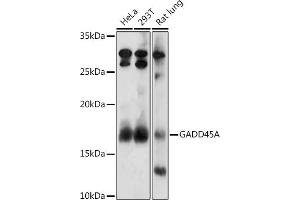 Western blot analysis of extracts of various cell lines, using GA antibody (ABIN3022563, ABIN3022564, ABIN3022565, ABIN1679943 and ABIN6218905) at 1:1000 dilution. (GADD45A 抗体  (AA 1-165))