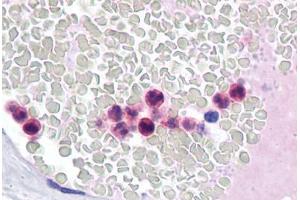 Human Neutrophils: Formalin-Fixed, Paraffin-Embedded (FFPE) (IRF4 抗体  (AA 342-452))