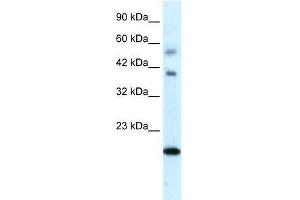 Human heart; WB Suggested Anti-CGI-143 Antibody Titration: 0. (BOLA1 抗体  (N-Term))