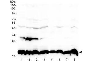 Western blot testing of 1) human placenta, 2) human U-87MG, 3) human HeLa, 4) mouse HEPA1-6, 5) rat PC-12, 6) rat RH35, 7) mouse NIH3T3 and 8) mouse SP20 lysate with Cyclophilin B antibody at 0. (PPIB 抗体)