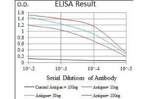 Black line: Control Antigen (100 ng), Purple line: Antigen(10 ng), Blue line: Antigen (50 ng), Red line: Antigen (100 ng),