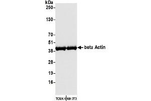 Western Blotting (WB) image for anti-Cytoskeletal Actin (CIMG_00972) (AA 1-50) antibody (ABIN7449436) (Recombinant Cytoskeletal Actin (CIMG_00972) (AA 1-50) 抗体)