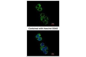ICC/IF Image Immunofluorescence analysis of methanol-fixed Hep G2, using GSTA2, antibody at 1:500 dilution. (GSTa2 抗体)