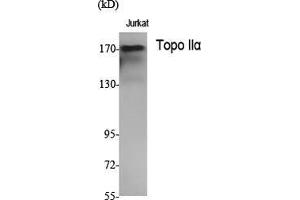 Western Blot (WB) analysis of specific cells using Topo IIalpha Polyclonal Antibody. (Topo IIalpha (N-Term) 抗体)