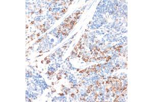 Immunohistochemistry of paraffin-embedded mouse spleen using HMGCR antibody (ABIN6293218) at dilution of 1:100 (40x lens). (HMGCR 抗体)