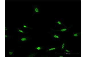 Immunofluorescence of monoclonal antibody to CRX on HeLa cell. (CRX 抗体  (AA 1-299))
