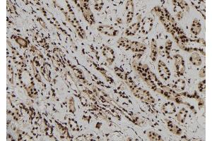 ABIN6277218 at 1/100 staining Human kidney tissue by IHC-P. (EPB41 抗体  (Internal Region))