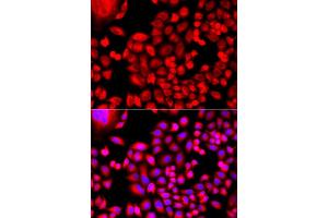 Immunofluorescence analysis of A549 cell using MTHFD1L antibody. (MTHFD1L 抗体)