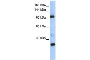 Western Blotting (WB) image for anti-Terminal Uridylyl Transferase 1, U6 SnRNA-Specific (TUT1) antibody (ABIN2458418) (TUT1 抗体)