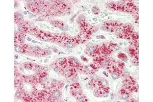 Formalin-fixed and paraffin-embedded H. (NMNAT3 抗体  (AA 150-178))