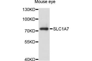 Western blot analysis of extract of mouse eye cells, using SLC1A7 antibody. (SLC1A7 抗体)