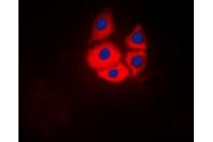 Immunofluorescent analysis of MARK4 staining in Jurkat cells. (MARK4 抗体  (Center))