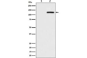 Western blot analysis of Phospho-CBL (S669) expression in (1) HeLa cell lysate, (2) HeLa cell treated with pervanadate lysate.