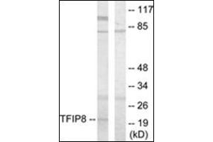 Western blot analysis of extracts from HuvEc cells using TFIP8 Antibody . (TNFAIP8 抗体)