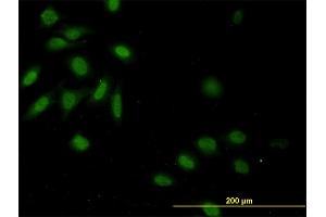 Immunofluorescence of monoclonal antibody to CASP9 on HeLa cell. (Caspase 9 抗体  (AA 1-416))