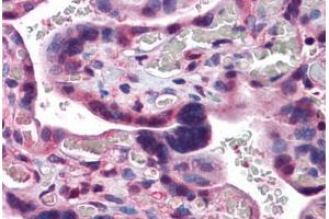 Human Placenta: Formalin-Fixed, Paraffin-Embedded (FFPE) (CAND1 抗体  (C-Term))