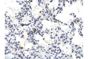 Rabbit Anti-SKIIP antibody        Paraffin Embedded Tissue:  Human Lung cell   Cellular Data:  Epithelial cells of renal tubule  Antibody Concentration:   4. (SNW1 抗体  (N-Term))