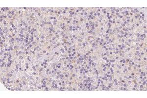 Immunohistochemistry (IHC) image for anti-Homocysteine-Inducible, Endoplasmic Reticulum Stress-Inducible, Ubiquitin-Like Domain Member 1 (HERPUD1) (N-Term) antibody (ABIN6262218)