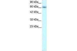 Human Raji; WB Suggested Anti-TRAFD1 Antibody Titration: 0. (TRAFD1 抗体  (C-Term))
