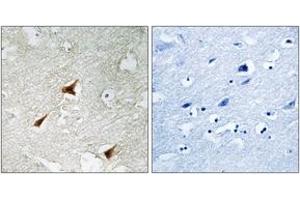 Immunohistochemistry analysis of paraffin-embedded human brain, using p19 INK4d Antibody. (CDKN2D 抗体  (AA 96-145))