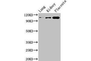 Western Blot Positive WB detected in: Mouse lung tissue, Mouse kidney tissue, Human placenta tissue All lanes: MSH4 antibody at 3 μg/mL Secondary Goat polyclonal to rabbit IgG at 1/50000 dilution Predicted band size: 105 kDa Observed band size: 105 kDa (MSH4 抗体  (AA 501-800))