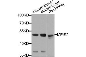 Western blot analysis of extracts of various cells, using MEIS2 antibody. (MEIS2 抗体)