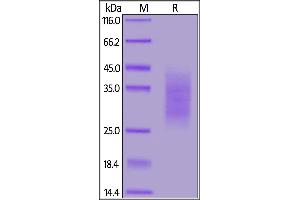 SDS-PAGE (SDS) image for Transforming Growth Factor, beta Receptor II (70/80kDa) (TGFBR2) (AA 23-159) (Active) protein (His tag,AVI tag,Biotin) (ABIN6973280)