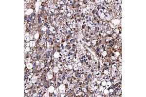 IHC analysis of TTC7B using anti-TTC7B antibody (ABIN7601050). (TTC7B 抗体  (AA 275-730))